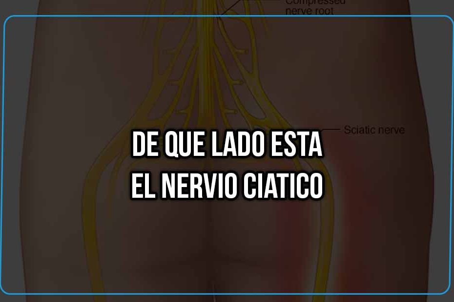 de que lado esta el nervio ciatico